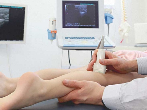 Диагностика варикоза ног в Киеве