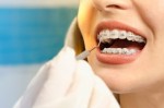 Какие виды услуг предоставляет стоматолог-ортодонт? Как найти хорошего ортодонта в Киеве?