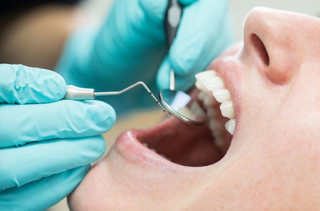 Методы безболезненно удалить зуб